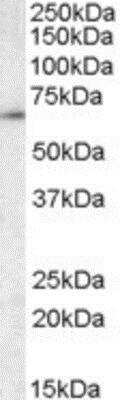 Western Blot: CCT3 Antibody [NBP1-51949]