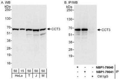 Western Blot: CCT3 Antibody [NBP1-79040]