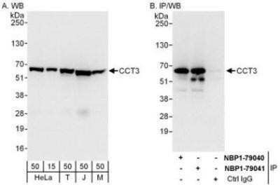 Western Blot: CCT3 Antibody [NBP1-79041]