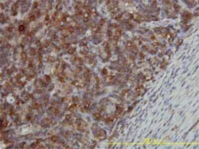 Immunohistochemistry-Paraffin: CCT5 Antibody (4E5-4B1) [H00022948-M01]