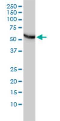 Western Blot: CCT5 Antibody (4E5-4B1) [H00022948-M01]