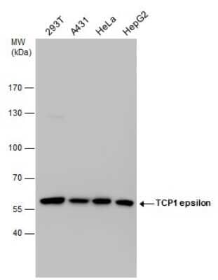 Western Blot: CCT5 Antibody (639) [NBP2-43680]