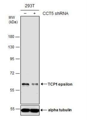 Western Blot: CCT5 Antibody (639) [NBP2-43680]