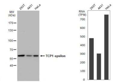 Western Blot: CCT5 Antibody (639) [NBP2-43680]