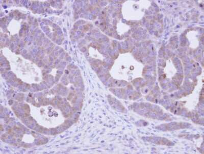 Immunohistochemistry-Paraffin: CCT5 Antibody [NBP1-31337]