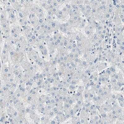 Immunohistochemistry-Paraffin: CCT5 Antibody [NBP1-83042]