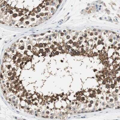 Immunohistochemistry-Paraffin: CCT5 Antibody [NBP1-83042]