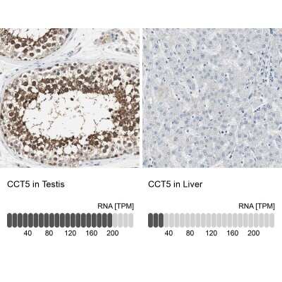 Immunohistochemistry-Paraffin: CCT5 Antibody [NBP1-83042]