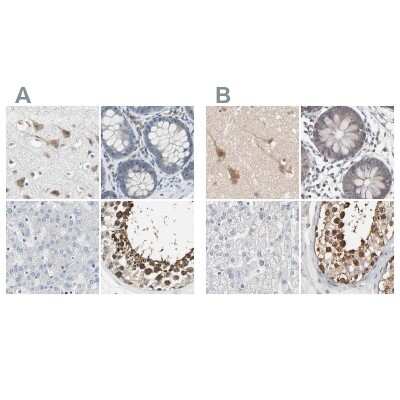 Immunohistochemistry-Paraffin: CCT5 Antibody [NBP1-83042]