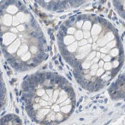Immunohistochemistry-Paraffin: CCT5 Antibody [NBP1-83042]