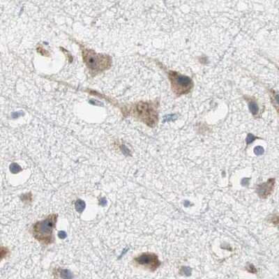 Immunohistochemistry-Paraffin: CCT5 Antibody [NBP1-83042]