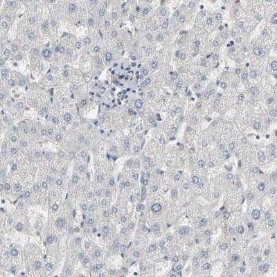 Immunohistochemistry-Paraffin: CCT5 Antibody [NBP1-83043]