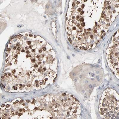 Immunohistochemistry-Paraffin: CCT5 Antibody [NBP1-83043]