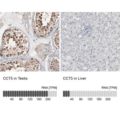 Immunohistochemistry-Paraffin: CCT5 Antibody [NBP1-83043]