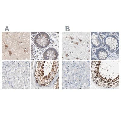 Immunohistochemistry-Paraffin: CCT5 Antibody [NBP1-83043]