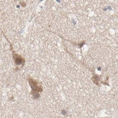 Immunohistochemistry-Paraffin: CCT5 Antibody [NBP1-83043]