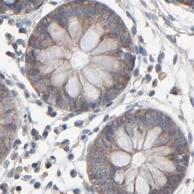 Immunohistochemistry-Paraffin: CCT5 Antibody [NBP1-83043]