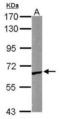 Western Blot: CCT5 Antibody [NBP1-31337]