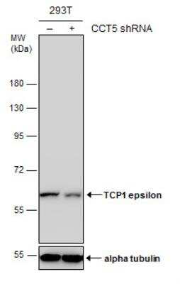 Western Blot: CCT5 Antibody [NBP1-31337]