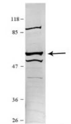 Western Blot: CCT5 Antibody [NBP1-56769]