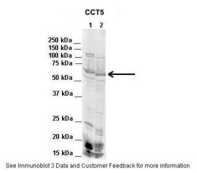 Western Blot: CCT5 Antibody [NBP1-56769]
