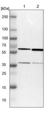 Western Blot: CCT5 Antibody [NBP1-83042]