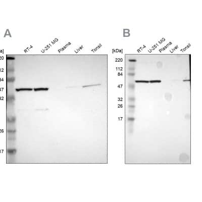 Western Blot: CCT5 Antibody [NBP1-83042]