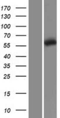 Western Blot: CCT5 Overexpression Lysate [NBP2-07497]