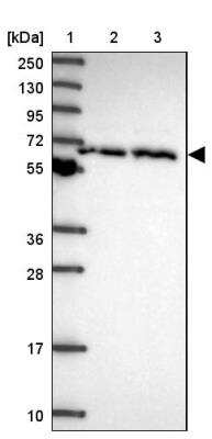 Western Blot: CCT6A Antibody [NBP2-46686]