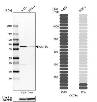 Western Blot: CCT6A Antibody [NBP2-46686]