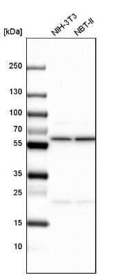Western Blot: CCT6A Antibody [NBP2-46686]
