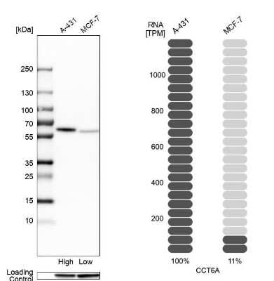 Western Blot: CCT6A Antibody [NBP2-46715]