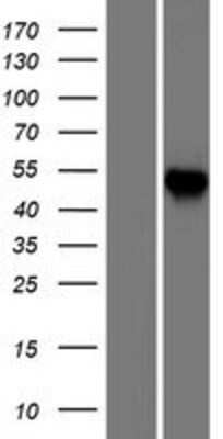 Western Blot: CCT6A Overexpression Lysate [NBP2-08704]