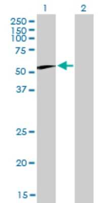 Western Blot: CCT6B Antibody (1A4) [H00010693-M01]