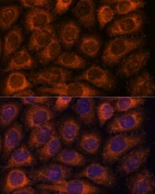Immunocytochemistry/ Immunofluorescence: CCT6B Antibody - Azide and BSA Free [NBP2-92177]