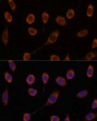 Immunocytochemistry/ Immunofluorescence: CCT6B Antibody - Azide and BSA Free [NBP2-92177]
