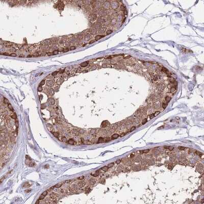 Immunohistochemistry-Paraffin: CCT6A Antibody [NBP2-33583]