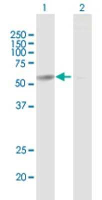 Western Blot: CCT6B Antibody [H00010693-B01P]