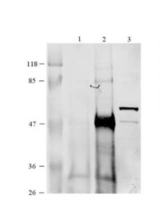 Western Blot: CCT6B Antibody [NBP1-56939]