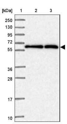 Western Blot: CCT6A Antibody [NBP2-33583]