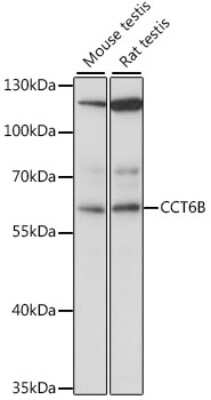 Western Blot: CCT6B AntibodyAzide and BSA Free [NBP2-92177]