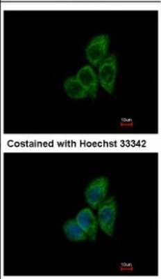 Immunocytochemistry/ Immunofluorescence: CCT8 Antibody [NBP2-15770]