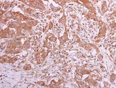 Immunohistochemistry-Paraffin: CCT8 Antibody [NBP1-33486]