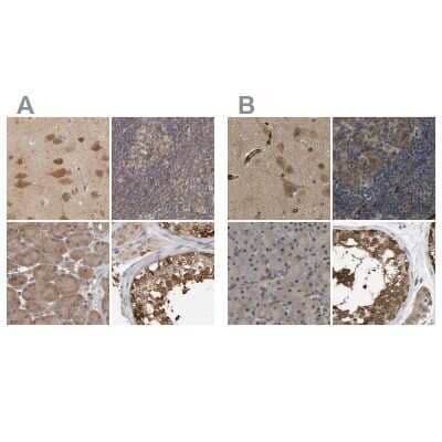 Immunohistochemistry-Paraffin: CCT8 Antibody [NBP1-88285]