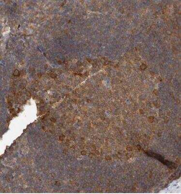 Immunohistochemistry-Paraffin: CCT8 Antibody [NBP1-88285]