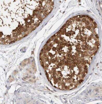 Immunohistochemistry-Paraffin: CCT8 Antibody [NBP1-88285]
