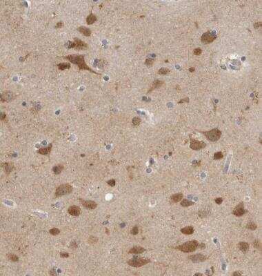 Immunohistochemistry-Paraffin: CCT8 Antibody [NBP1-88285]