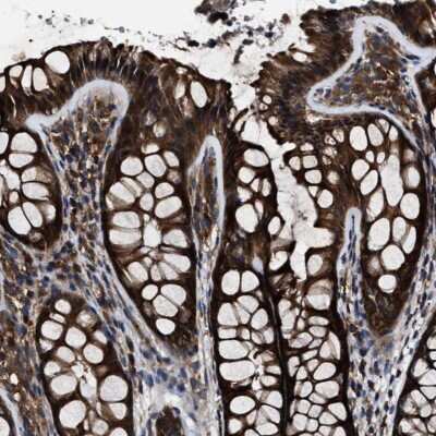 Immunohistochemistry-Paraffin: CCT8 Antibody [NBP1-88286]