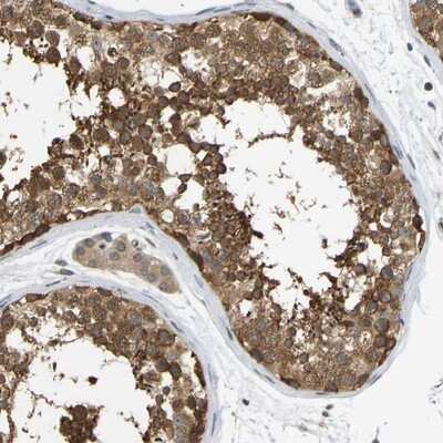 Immunohistochemistry-Paraffin: CCT8 Antibody [NBP1-88287]
