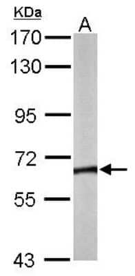 Western Blot: CCT8 Antibody [NBP1-33486]